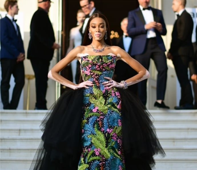 Winnie Harlow